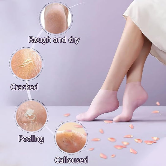 2 Pairs Silicone Socks for Dry Cracked Feet, Women's Foot Socks for Moisturizing (2 Colors Assorted, Fits Up to Size 10)