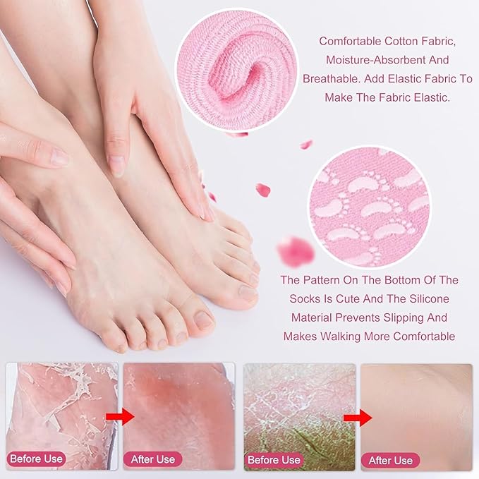 Premium Quality Anti-Cracking Moisturizing Foot Care Women's Reusable Silicone Gel Heel Socks for Cracked Heels