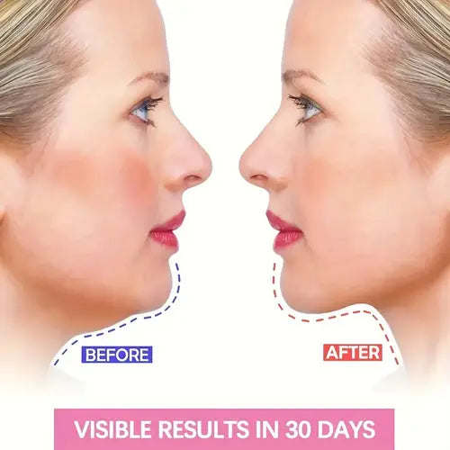 Face V Shaper Facial Slimming Bandage Relaxation Lift Up Belt Shape Lift Reduce Double Chin Face Thining Band Massage
