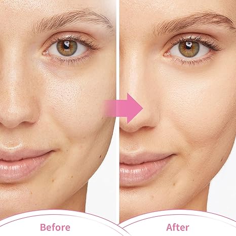 Hot and Cold Therapy Gel Bead Full Facial Mask for Migraine Headache, Stress Relief ,Reduces Eye Puffiness, Dark Circles | Fabric Back (Full Face with Eye Holes)